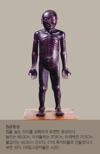 침금동상 - 침을 놓는 자리를 정확하게 표현한 동상이다. 높이는 86.0Cm, 머리둘레는 37.8Cm, 어깨폭은 22.5Cm, 팔길이는 40.0Cm 규모다. 2:1의 축적비율로 만들었다고 보면 된다. (국립고궁박물관 소장)